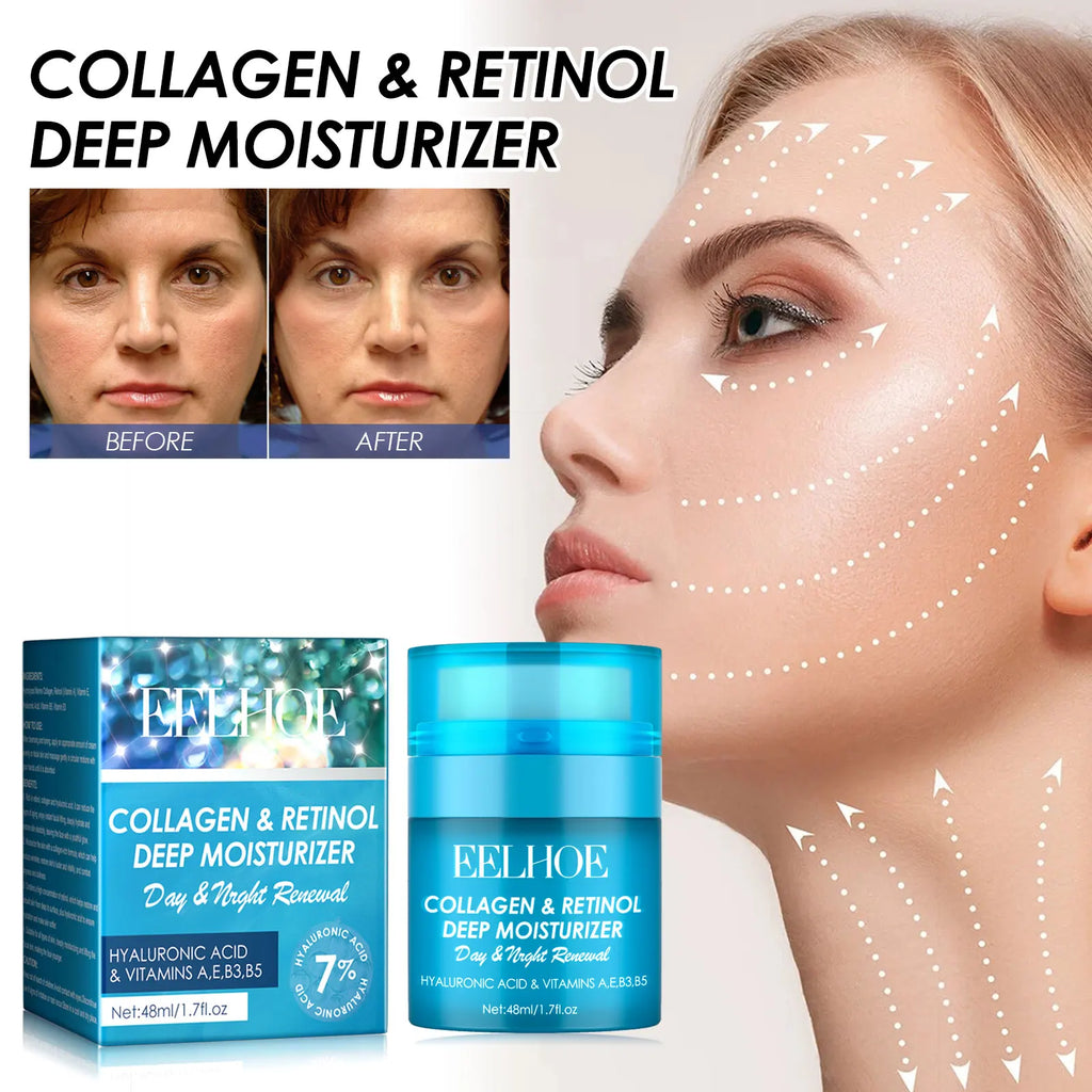 Eelhoe 48ml Retinol Moisturizer Cream Remove Wrinkle Reduce Fine Lines Tender Skin Collagen Boost Hydrating Facial Care Cream mbzr