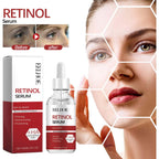 Retinol Serum Reduce Wrinkles Improve Dull Skin Rich Tender Skin Radiant Beautify Facial Moisturizing Hydrating Smooth Essence mbzr