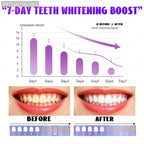 POZOAMIS Purple Yellow Teeth Remover Brush, whitens and brightens teeth, freshens breath, repairs and cleans toothpaste, removes plaque, black teeth, and cavities, teeth whitening, oral care tool mbzr