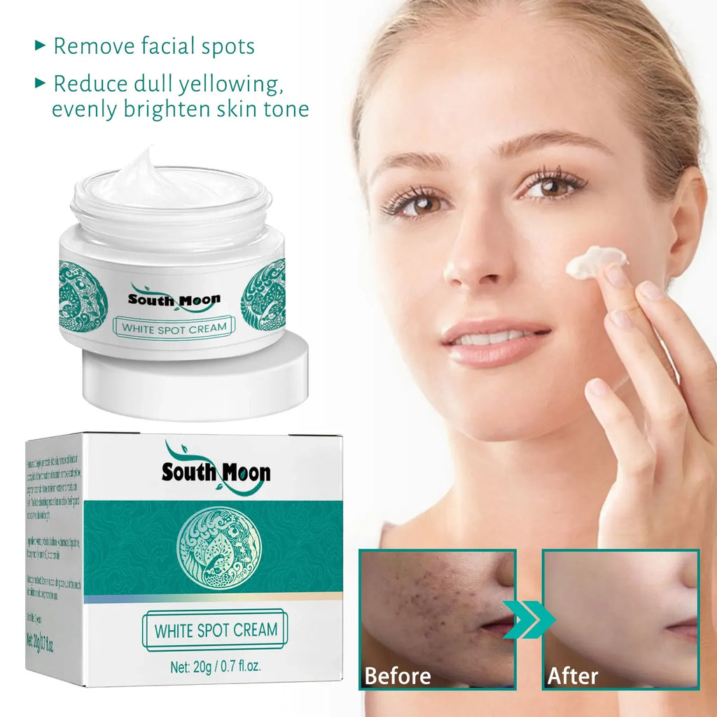 Dry, Dull Skin with Dark Spots? This Face Cream Moisturizes, Softens, and Helps Fade Imperfections for a Glowing Complexion mbzr