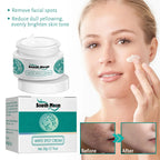Dry, Dull Skin with Dark Spots? This Face Cream Moisturizes, Softens, and Helps Fade Imperfections for a Glowing Complexion mbzr