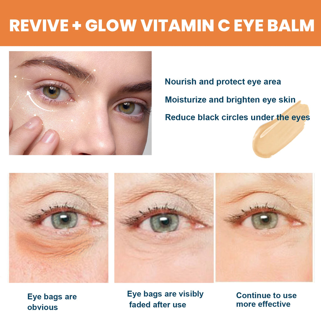 Vitamin C Eye Cream Nourishing Remove Dark Circles Fade Fine Lines Enhance Skin Elasticity Glowing Eye Skin Cream mbzr