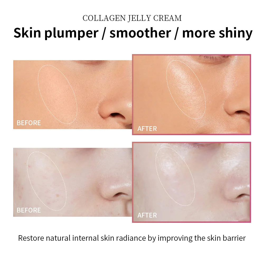 Anti Aging Collagen Face Cream 100ml Niacinamide Moisturizer Hydrating Gel For Tightening Soothing Firmness Skincare mbzr