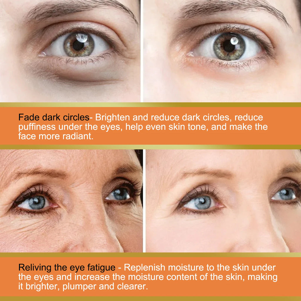 Vitamin C Eye Cream Nourishing Remove Dark Circles Fade Fine Lines Enhance Skin Elasticity Glowing Eye Skin Cream mbzr