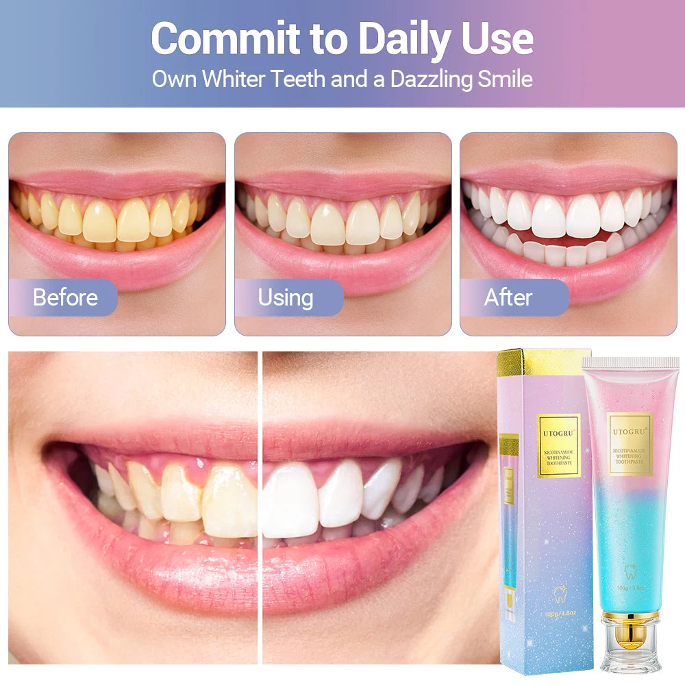Niacinamide Whitening Toothpaste Refreshing Clean Teeth For Men And Women Fresh Breath Toothpaste To Remove Surface Stains mbzr