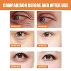 Vitamin C Eye Cream Nourishing Remove Dark Circles Fade Fine Lines Enhance Skin Elasticity Glowing Eye Skin Cream mbzr