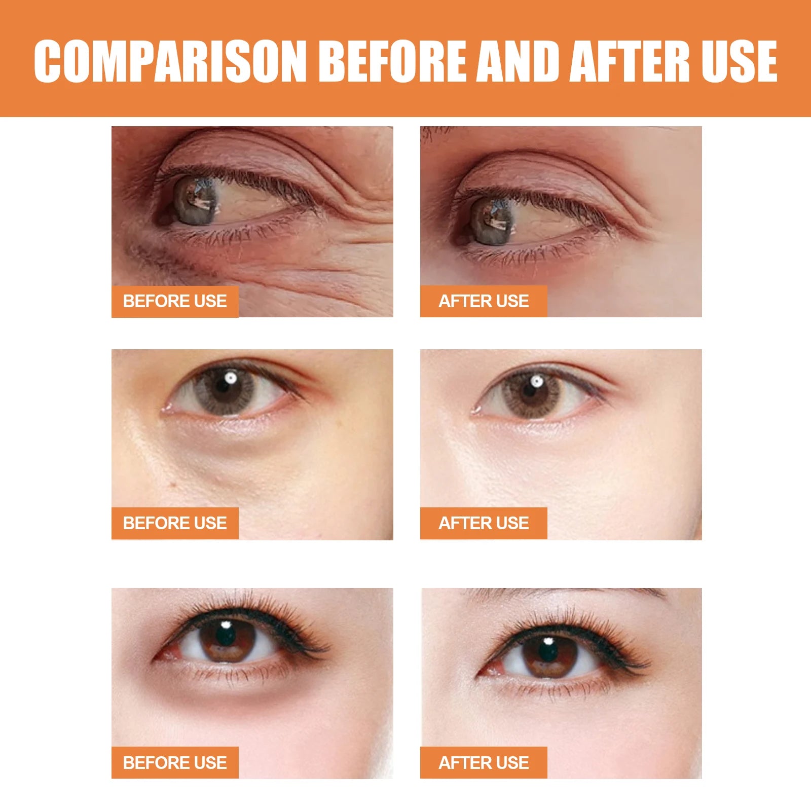 Vitamin C Eye Cream Nourishing Remove Dark Circles Fade Fine Lines Enhance Skin Elasticity Glowing Eye Skin Cream mbzr