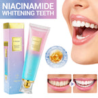 Niacinamide Whitening Toothpaste Refreshing Clean Teeth For Men And Women Fresh Breath Toothpaste To Remove Surface Stains mbzr