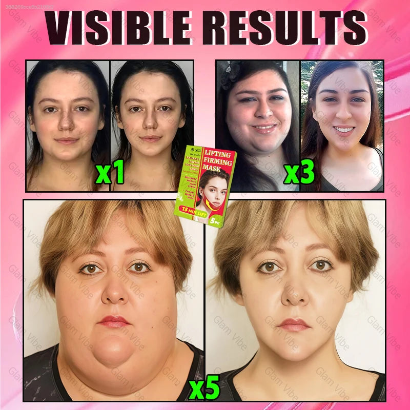 V-Shaped Cooling Slimming Face Mask: Removes masseter muscles, tightens double chin, burns facial fat, deeply hydrates, shaping bandage anti-aging beauty product, new product launch mbzr